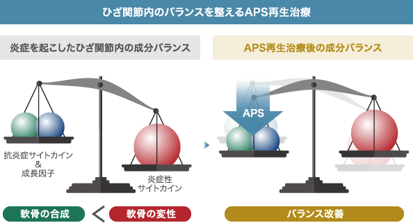 ひざ関節内のバランスを整えるAPS再生治療: 炎症を起こしたひざ関節内の成分バランス: 抗炎症サイトカイン & 成長因子 / 軟骨の合成 < 炎症性サイトカイン 軟骨の変性 | APS再生治療後の成分バランス: APS バランス改善