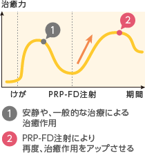 1. 安静や、一般的な治療による治癒作用 / 2. PRP-FD注射により再度、治癒作用をアップさせる