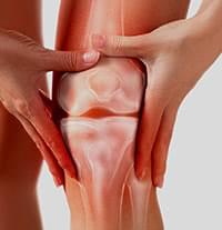 膝の痛みの原因となる、変形性膝関節症