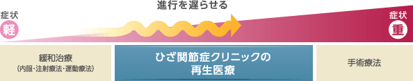 症状が軽い間は緩和治療（内服・注射療法・運動療法）を行うが、症状が重くなり手術療法を行わざるを得なくなる前に変形性ひざ関節症外来の再生医療という新しい選択肢が加わることで、変形性ひざ関節症の痛みの改善に加え、従来の処置よりも進行を遅らせるという効果をのぞむことはできます