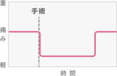 効果の出方（イメージ）人工関節手術