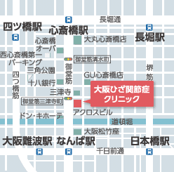 40代以上は必見 膝痛の原因と治し方に関する保田院長監修サイトがオープン 大阪院のお知らせ 40代以上は必見 膝痛の原因と治し方に関する保田院長監修サイトがオープン 大阪院のお知らせ